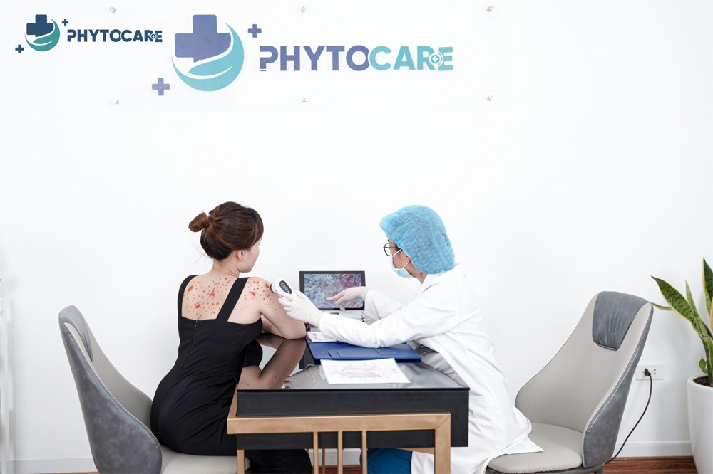 Đánh giá hiệu quả điều trị vảy nến tại Phòng khám da liễu Phytocare Hà Nội - 4