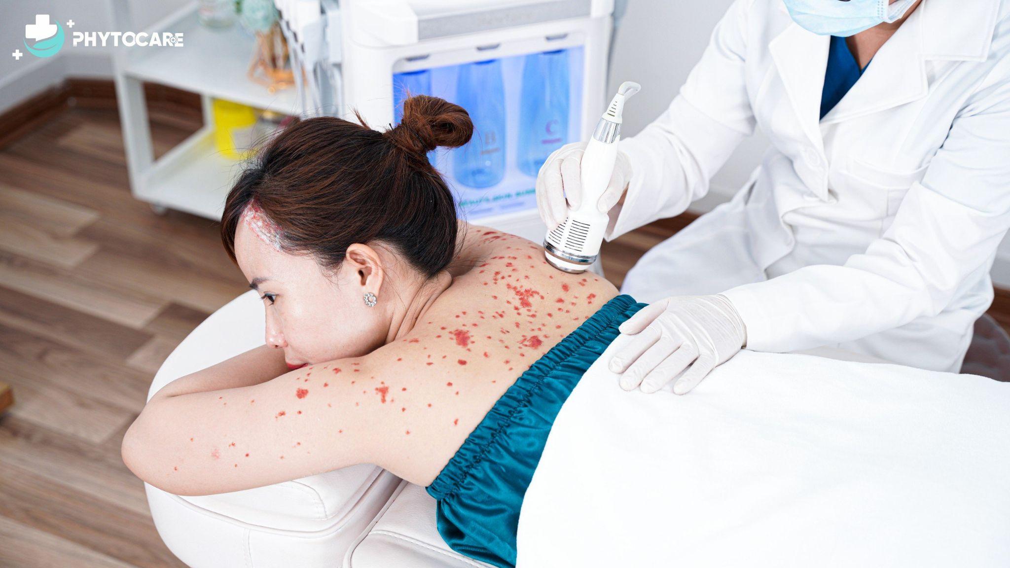 Đánh giá hiệu quả điều trị vảy nến tại Phòng khám da liễu Phytocare Hà Nội - 5