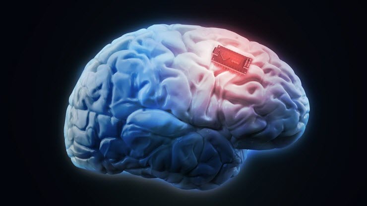 Elon Musk muốn cấy ghép bộ phận AI vào não người.