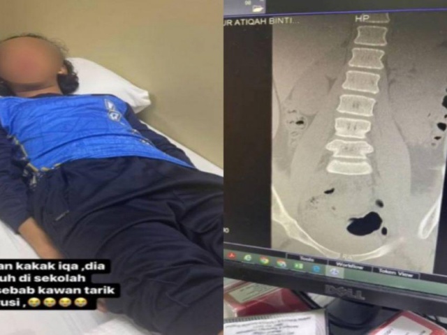 Giáo dục - du học - Bé gái phải nằm liệt giường sau trò đùa ác ý của các bạn học ở trường