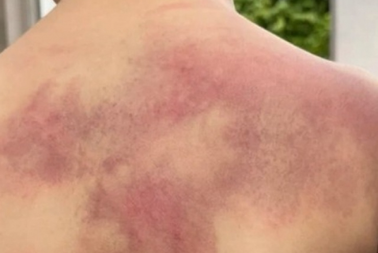 Tạm giữ cha ruột đánh dã man con trai