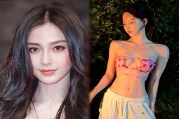 Làm đẹp - Người đẹp chi hơn 18 tỷ "dao kéo" gương mặt để giống với Angelababy sau 3 năm ra sao?