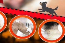 Tin tức trong ngày - Bé gái bị 4 con chó tấn công với hàng trăm vết thương trên người