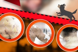 Tin tức trong ngày - Bé gái bị 4 con chó tấn công với hàng trăm vết thương trên người