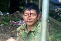 Pháp luật - Phẫn nộ người chồng dùng điếu cày hành hung vợ vì không cho dùng điện thoại