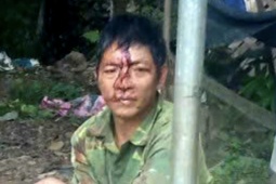 Pháp luật - Phẫn nộ người chồng dùng điếu cày hành hung vợ vì không cho dùng điện thoại