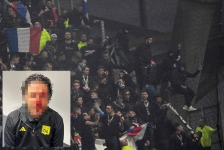 HLV Grosso đổ máu, 9 CĐV bị bắt sau bạo loạn gây rúng động bóng đá Pháp