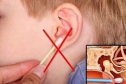 Sức khỏe đời sống - Bỏ ngay những cách lấy ráy tai sai lầm này kẻo điếc vĩnh viễn