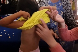 Tin tức trong ngày - Giải cứu bé gái 4 tuổi bị cha nuôi đánh đập ở Cà Mau