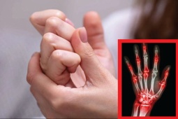 Sức khỏe đời sống - 3 thói quen tưởng vô hại nhưng âm thầm "tự đầu độc" xương khớp - bỏ càng sớm càng tốt