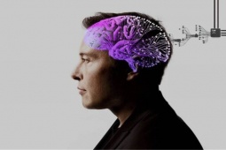 Công nghệ thông tin - Sốc: Hàng ngàn người sẵn sàng "xẻ" hộp sọ để cấy chip của Elon Musk
