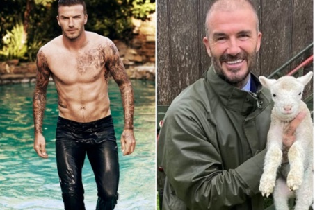 Beckham để lộ đầu hói nặng khó chữa làm nhiều người giật mình