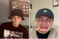 Đàn ông - Nam thần một thời đẹp nhất xứ Trung đi phẫu thuật thẩm mỹ và cái kết "đẫm nước mắt"