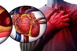 Sức khỏe đời sống - 3 điều tuyệt đối không làm khi lên cơn đau tim