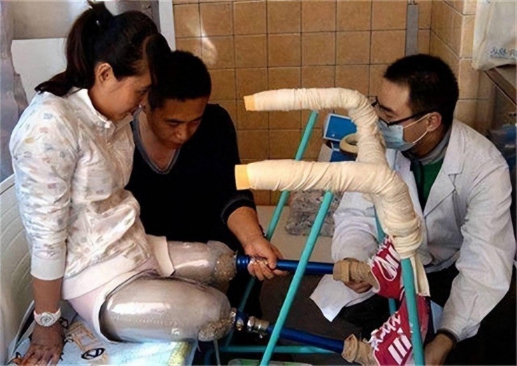 Cô Trương làm quen với "đôi chân" mới. Ảnh: Sohu