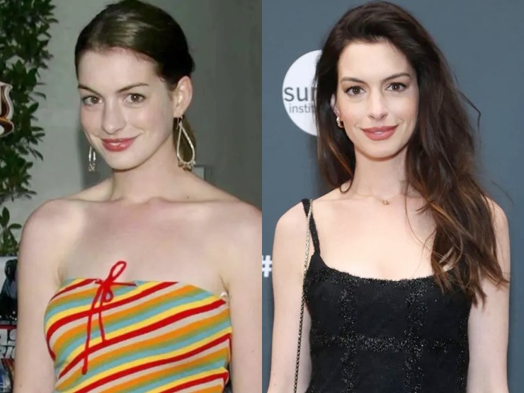 Sắc sóc năm 2013 (bên trái) và 2023 (bên phải) của Anne Hathaway.