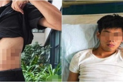 Bạn trẻ - Cuộc sống - Cuộc sống hiện tại của chàng trai 17 tuổi bán thận để mua iPhone: Bị bệnh tâm lý, có xu hướng từ bỏ bản thân