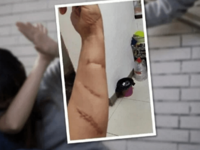 Bạn trẻ - Cuộc sống - Sẵn sàng lấy thân đỡ 20 nhát chém cứu bạn, cô gái không ngờ bạn lại là người “vong ân bội nghĩa”