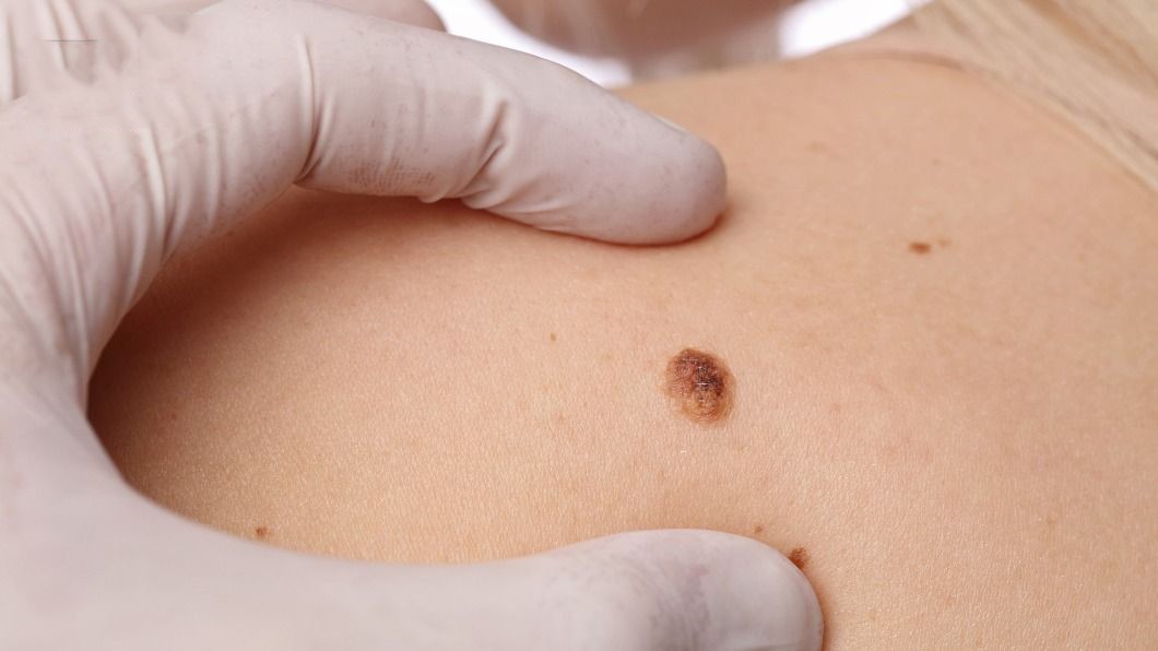 Nam giới có 5 dấu hiệu này cần cảnh giác, phát hiện muộn có thể khó chữa trị - 2