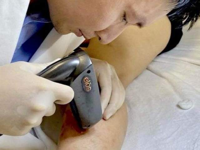 Sức khỏe đời sống - Người đàn ông 35 tuổi phải cắt bỏ chân do chủ quan với dấu hiệu này khi tập gym