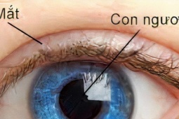 Công nghệ thông tin - Mống mắt nằm ở đâu, vì sao được lấy làm dữ liệu thẻ căn cước?