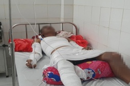 Tin tức trong ngày - Nổ ghe biển, 3 người bị thương