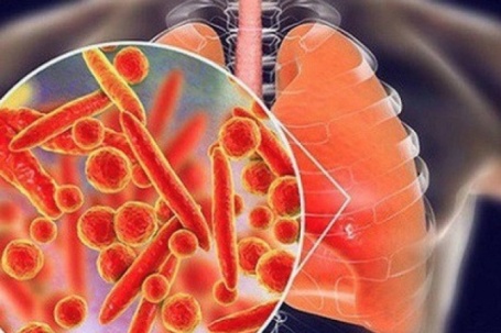 5 nhóm thực phẩm làm sạch phổi, tốt cho đường hô hấp, mùa đông nên ăn thường xuyên