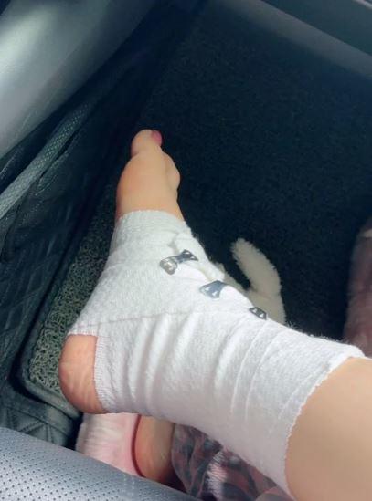 Quỳnh Kool bị thương, bó bột chân khi đóng "Chúng ta của 8 năm sau" - 6