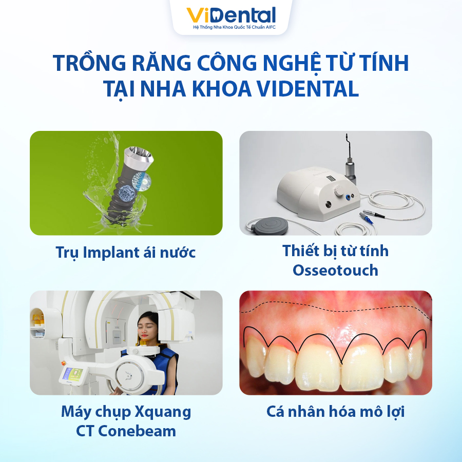 ViDental cam kết chính sách trồng răng giá tốt, hiệu quả như ý - 5