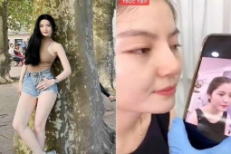 Làm đẹp - Vợ sắp cưới của Quang Hải công khai chỉnh sửa một điểm trên mặt nhằm có nét đẹp "ngọc nữ"