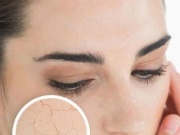 Sức khỏe đời sống - Da khô nứt nẻ mùa đông nên ăn ngay những thực phẩm này bởi giữ ẩm cực tốt