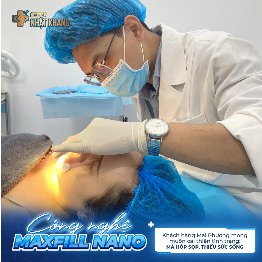 Thực hiện liệu trình Maxfill Nano cho khách hàng