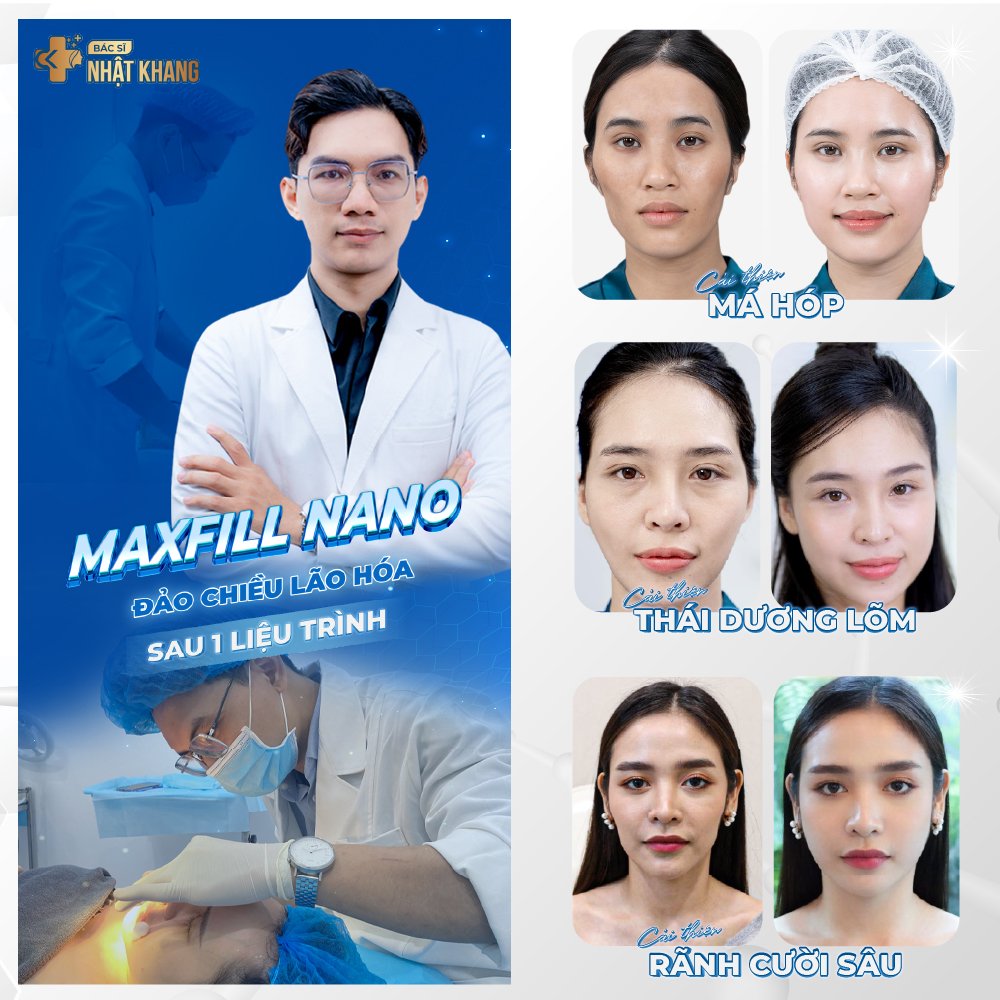 Maxfill Nano - Đảo chiều lão hoá chỉ sau 1 liệu trình