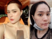 Làm đẹp - "Nữ đại gia quận 7" từng chi nửa tỷ chăm sóc da, có lúc mặt chi chít mụn đến sợ vì lý do này