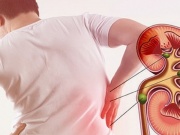 Sức khỏe đời sống - 6 nguyên nhân gây sỏi thận nhiều người mắc phải