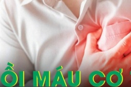 Dấu hiệu cảnh báo nhồi máu cơ tim cấp ai cũng nên biết