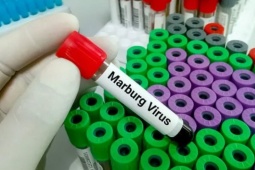 Virus Marburg nguy hiểm thế nào?