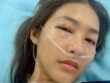 Khả Ngân nhập viện cấp cứu