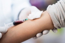 Sức khỏe đời sống - Có những xét nghiệm máu nào mà bạn không cần nhịn ăn?