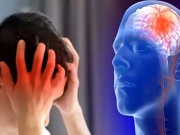 Sức khỏe đời sống - 3 bất thường liên quan giấc ngủ cảnh báo nguy cơ nhồi máu não