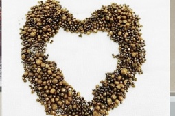 Sức khỏe đời sống - Hàng trăm viên sỏi được lấy ra từ túi mật của người phụ nữ