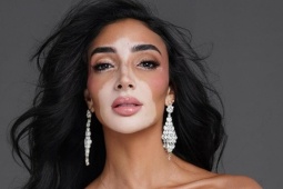 Thời trang - Hoa hậu Hoàn vũ Ai Cập - thí sinh có vẻ đẹp khác lạ ở Miss Universe 2024