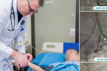 Người phụ nữ ở Phú Thọ bị nhồi máu cơ tim cấp có tiền sử mắc 4 bệnh lý...