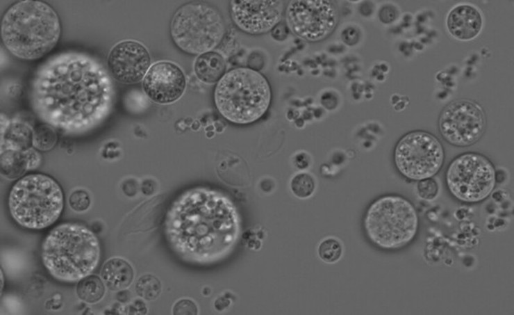 Việc khám phá ra sinh vật đơn bào Chromosphaera perkinsii là chìa khóa trả lời cho vấn đề.