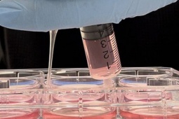 Sức khỏe đời sống - Sốc: Trí nhớ của con người không chỉ tồn tại trong não