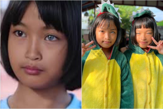 Cặp song sinh 9 tuổi nổi tiếng vì sở hữu mắt màu xanh. Ảnh: Newsflare