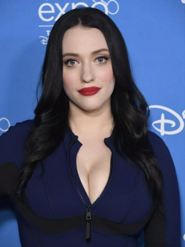 Kat Dennings chịu đựng căn bệnh đau nửa đầu hơn 20 năm qua.