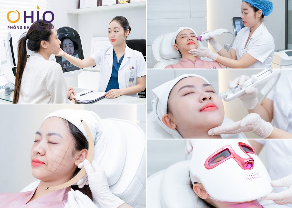 Khách hàng trải qua quy trình chuẩn y khoa tại Phòng khám da liễu OHIO