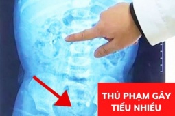 Tin tức sức khỏe - Ai cũng nghĩ đi tiểu ngày hơn 8 lần, đêm 3- 4 lần là bình thường, cho đến khi chuyên gia vạch trần thủ phạm mới vỡ lẽ