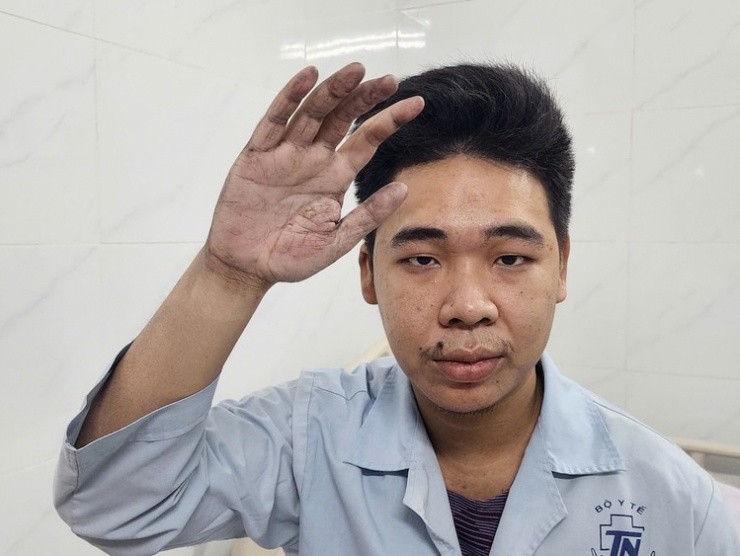 Nạn nhân vụ cháy ở TP HCM: &#39;Chậm vài giây tôi chết ngạt&#39; - 2